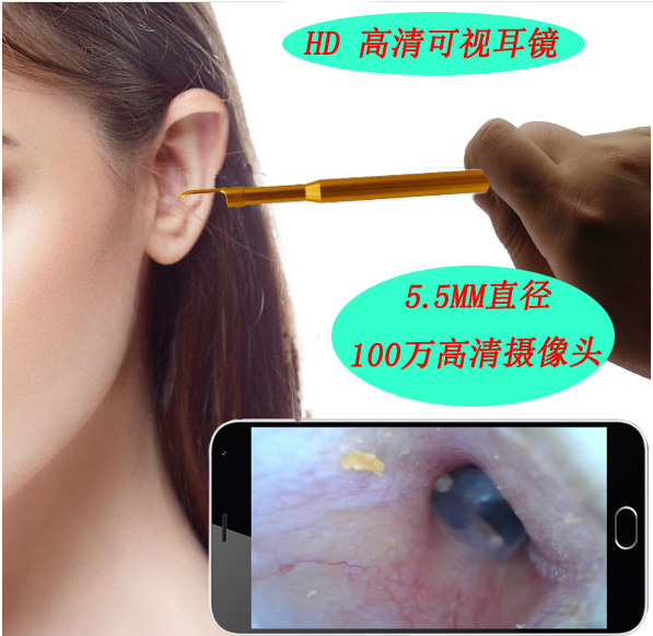 Wireless USB ear endoscope digital otoscope with spoon
